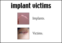 Implant Victims home page